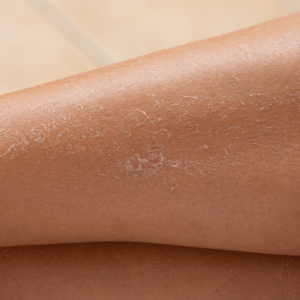 Peeling detox HQP