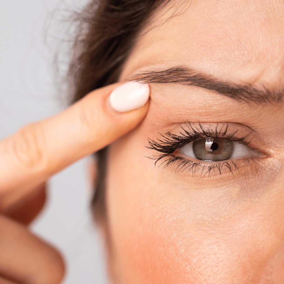 Phion Blefaroplastia sin Cirugía